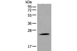 Western blot analysis of Human liver tissue lysate using APOD Polyclonal Antibody at dilution of 1:550 (Apolipoprotein D antibody)