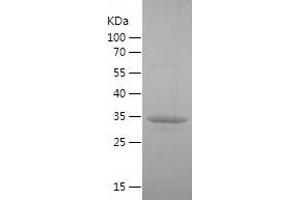 Western Blotting (WB) image for Hydroxysteroid (11-Beta) Dehydrogenase 1 (HSD11B1) (AA 196-292) protein (His-IF2DI Tag) (ABIN7123384) (HSD11B1 Protein (AA 196-292) (His-IF2DI Tag))