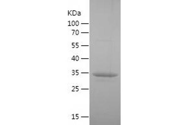 HSD11B1 Protein (AA 196-292) (His-IF2DI Tag)