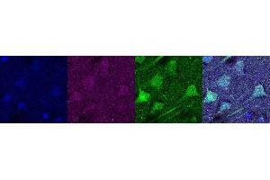 Immunohistochemistry (IHC) image for anti-Ubiquitin Carboxyl-terminal Esterase L1 (Ubiquitin Thiolesterase) (UCHL1) antibody (ABIN7456167) (UCHL1 antibody)