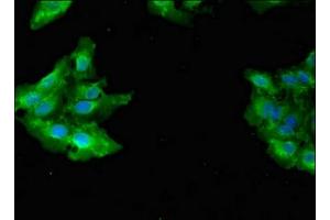 Immunofluorescent analysis of Hela cells using ABIN7154436 at dilution of 1:100 and Alexa Fluor 488-congugated AffiniPure Goat Anti-Rabbit IgG(H+L) (GAB2 antibody  (AA 273-484))