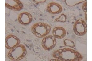 Immunohistochemistry (IHC) image for anti-Keratin 18 (KRT18) (AA 238-396) antibody (ABIN7433288)