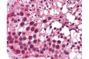 Human Testis; Testis; KLF9 Antibody - N-terminal region in Human Testis cells using Immunohistochemistry (KLF9 antibody  (N-Term))