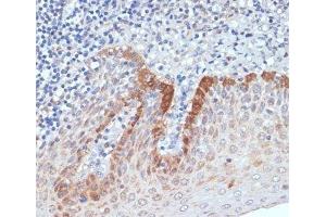 Immunohistochemistry of paraffin-embedded Human tonsil using CXCL12 Polyclonal Antibody at dilution of 1:100 (40x lens). (CXCL12 antibody)