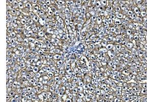 IHC analysis of EGFR using anti-EGFR antibody (ABIN7600915). (EGFR antibody  (AA 25-596))