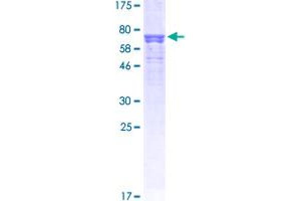AGT Protein (AA 34-485) (GST tag)