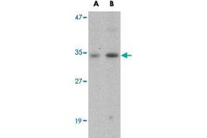 Western blot analysis of GNPDA1 in mouse kidney tissue lysate with GNPDA1 polyclonal antibody  at (A) 1 and (B) 2 ug/mL . (GNPDA1 antibody  (C-Term))