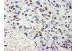 Immunohistochemistry (IHC) image for anti-hSET1 (AA 1200-1250) antibody (ABIN7448601) (hSET1 (AA 1200-1250) antibody)