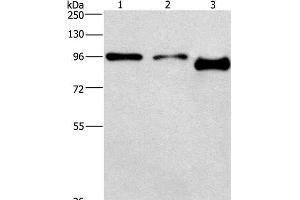 Western Blot analysis of A431 and hela cell,Mouse brain tissue using PIP5K1C Polyclonal Antibody at dilution of 1:500 (PIP5K1C antibody)