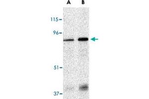 Western blot analysis of EIF2AK2 in Caco-2 whole cell lysate with EIF2AK2 polyclonal antibody  at (A) 1 and (B) 2 ug/mL .