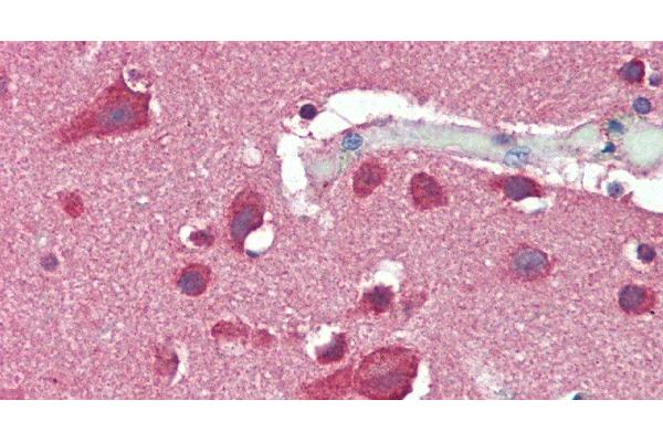 SLC8A3 antibody
