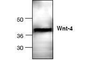 Image no. 1 for anti-Wingless-Type MMTV Integration Site Family, Member 4 (WNT4) antibody (ABIN127200) (WNT4 antibody)