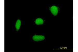 Immunofluorescence of purified MaxPab antibody to ELAC2 on HepG2 cell. (ELAC2 antibody  (AA 1-826))