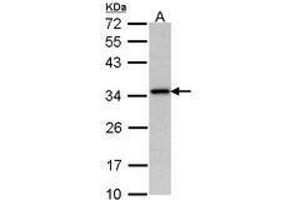 Image no. 1 for anti-N-Acetyltransferase 1 (Arylamine N-Acetyltransferase) (NAT1) (AA 1-157) antibody (ABIN467615)