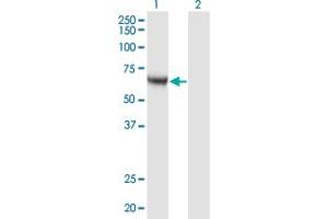 CAMKK1 antibody  (AA 2-100)