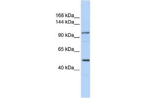 WB Suggested Anti-KIAA1618 Antibody Titration:  0. (RNF213 antibody  (N-Term))