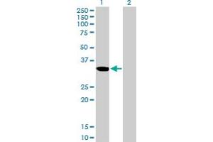 Western Blot analysis of ZNF215 expression in transfected 293T cell line by ZNF215 MaxPab polyclonal antibody. (ZNF215 antibody  (AA 1-304))