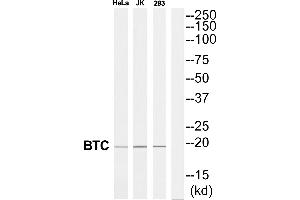 Western blot analysis of extracts from 293/Jurkat/HeLa cells, using BTC antibody. (Betacellulin antibody  (Internal Region))