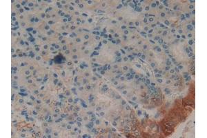 Used in DAB staining on fromalin fixed paraffin- embedded spleen tissue (FABP2 antibody  (AA 2-132))