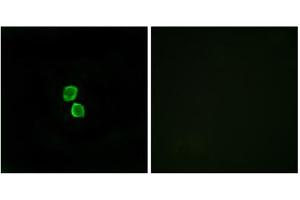 Immunofluorescence analysis of MCF-7 cells, using CKLF1 antibody.