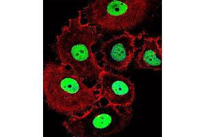 Fluorescent confocal image of MCF-7 cell stained with HOXC10 Antibody (Center) (ABIN1537883 and ABIN2849158). (HOXC10 antibody  (AA 152-179))