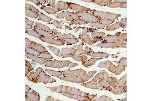 Immunohistochemical analysis of Beta2A-tubulin staining in mouse skeletal muscle formalin fixed paraffin embedded tissue section. (TUBB2A antibody)