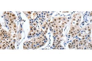 MAGEA6 antibody