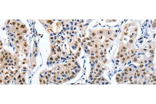 MAGEA6 antibody