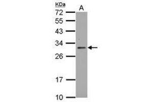 Image no. 1 for anti-TP53 induced glycolysis regulatory phosphatase (TIGAR) (AA 1-270) antibody (ABIN1497017) (TIGAR antibody  (AA 1-270))