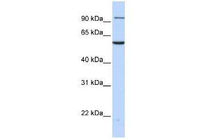 Transportin 2 antibody used at 1 ug/ml to detect target protein.