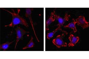 Confocal immunofluorescence analysis of SKBR-3 (left) and A549 (right) cells using beta Actin mouse mAb (red, the secondary Ab is Cy3-Goat anti mouse IgG). (beta Actin antibody  (N-Term))