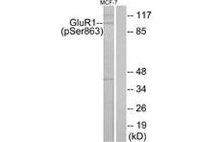 Western blot analysis of extracts from MCF-7 cells, using GluR1 (Phospho-Ser863) Antibody. (Glutamate Receptor 1 antibody  (pSer863))