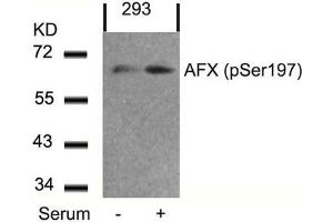 Western blot analysis of extracts from 293 cells untreated or treated with serum using AFX(Phospho-Ser197) Antibody. (FOXO4 antibody  (pSer197))
