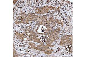 IHC analysis of DTR/HBEGF using anti-DTR/HBEGF antibody (ABIN7603042). (HBEGF antibody  (Middle Region))