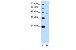 Image no. 1 for anti-SMAD, Mothers Against DPP Homolog 7 (SMAD7) (N-Term) antibody (ABIN324250) (SMAD7 antibody  (N-Term))