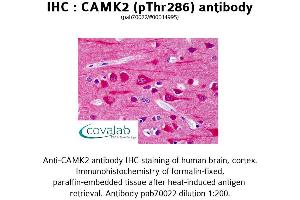 Image no. 1 for anti-Calcium/calmodulin-Dependent Protein Kinase II beta (CAMK2B) (pThr286) antibody (ABIN1732578) (CAMK2B antibody  (pThr286))