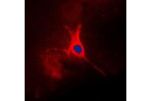 Immunofluorescent analysis of TACSTD2 staining in A549 cells. (TACSTD2 antibody  (Center))