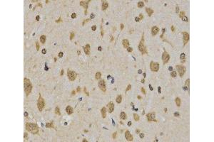 Immunohistochemistry of paraffin-embedded Rat brain using TriMethyl-Histone H3-K4 Polyclonal Antibody at dilution of 1:200 (40x lens).