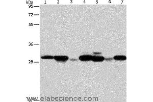 Western blot analysis of Human placenta tissue and A549 cell, mouse brain tissue and hepG2 cell, Raji cell and human fetal liver tissue, hela cell, using AK2 Polyclonal Antibody at dilution of 1:250 (Adenylate Kinase 2 antibody)
