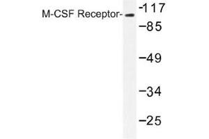 Image no. 1 for anti-Colony Stimulating Factor 1 Receptor (CSF1R) antibody (ABIN317880) (CSF1R antibody)