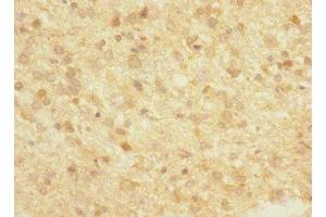 FBXO2 antibody  (AA 1-296)