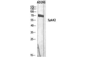 Western Blotting (WB) image for anti-Sphingosine Kinase 2 (SPHK2) (Tyr754) antibody (ABIN3177484) (SPHK2 antibody  (Tyr754))