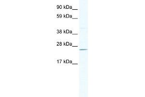 WB Suggested Anti-DNAJC17 Antibody Titration:  2. (DNAJC17 antibody  (N-Term))