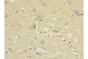 Immunohistochemistry of paraffin-embedded human brain tissue using ABIN7150518 at dilution of 1:100 (DNAJB2 antibody  (AA 215-324))