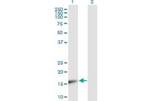 Western Blot analysis of UBE2V1 expression in transfected 293T cell line by UBE2V1 MaxPab polyclonal antibody. (UBE2V1 antibody  (AA 1-147))