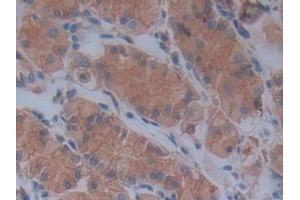 Immunohistochemistry (IHC) image for anti-Fibrillin 1 (FBN1) (AA 246-389) antibody (ABIN7438742)