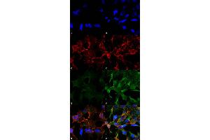Immunocytochemistry/Immunofluorescence analysis using Mouse Anti-Acrolein Monoclonal Antibody, Clone 2H2 . (Acrolein antibody  (APC))