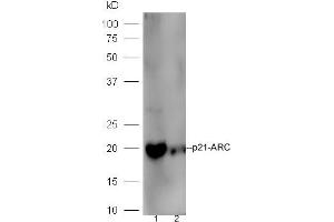 Line1,mouse intestinal lysate; Line2, Raji lysate probed with Rabbit Anti-p21-ARC Polyclonal Antibody, Unconjugated (ABIN2178124) at 1:300 in 4˚C. (ARPC3 antibody  (AA 2-100))