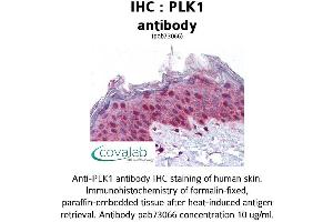 Image no. 3 for anti-Polo-Like Kinase 1 (PLK1) (AA 161-440) antibody (ABIN1738157) (PLK1 antibody  (AA 161-440))