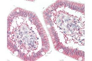 Human Small Intestine: Formalin-Fixed, Paraffin-Embedded (FFPE) (SLC7A8 antibody)